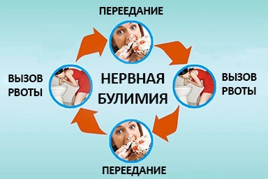 Лечение булимии в Коряжме